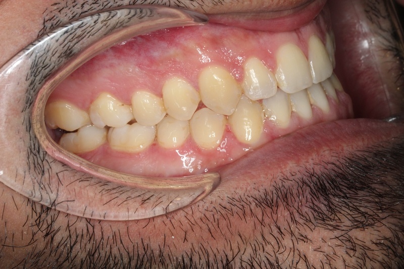 After treatment - patient 100