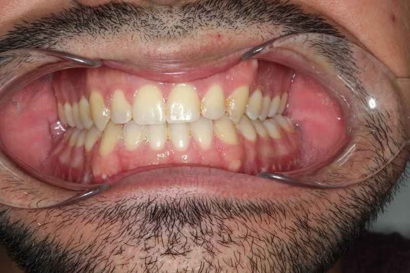 After treatment - patient 101