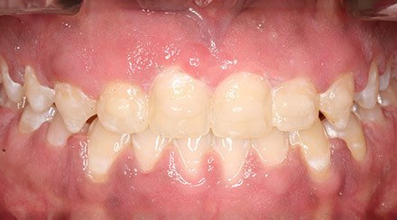 After treatment - patient 102