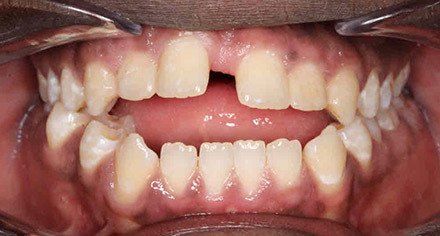 Before treatment - patient 102