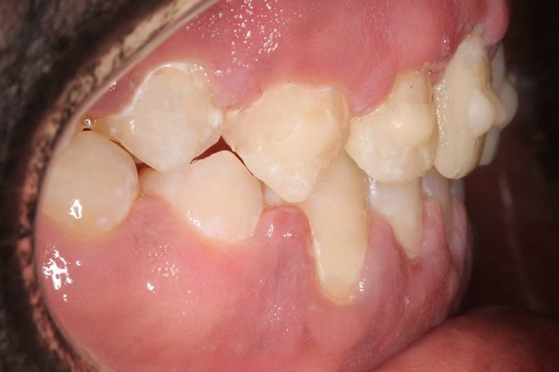 After treatment - patient 103