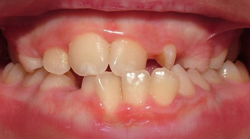 Before treatment - patient 9