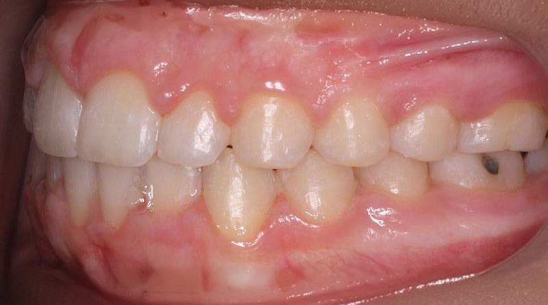 After treatment - patient 24