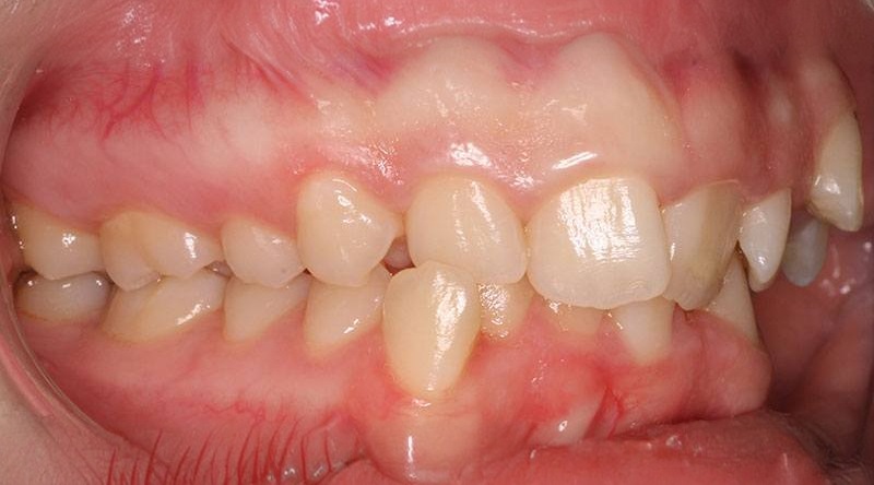 Before treatment - patient 34