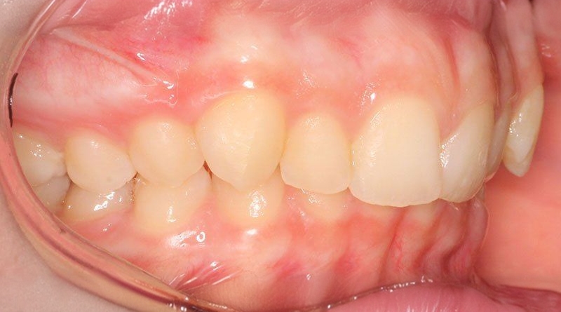 Before treatment - patient 40