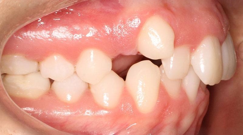 Before treatment - patient 47