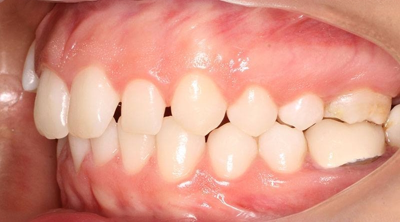 Before treatment - patient 48