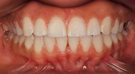 After treatment - patient 59