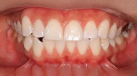 Before treatment - patient 59