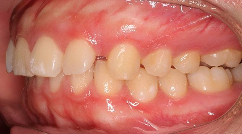 Before treatment - patient 19