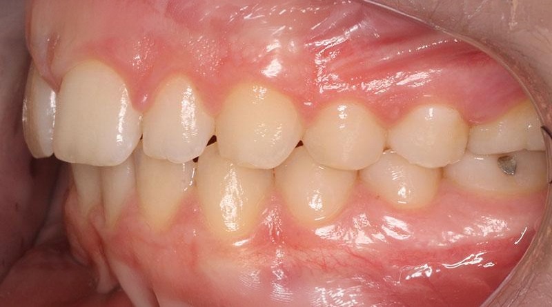 Before treatment - patient 24