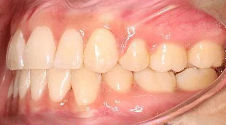 After treatment - patient 63