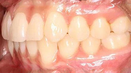 Before treatment - patient 63