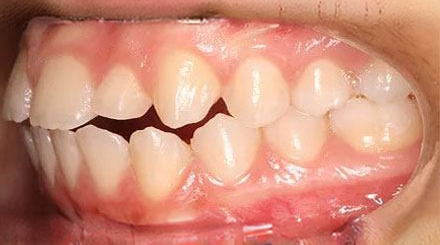 Before treatment - patient 66