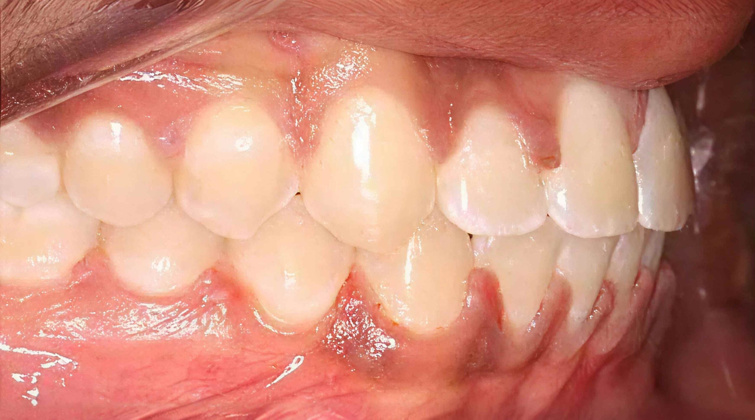 After treatment - patient 67