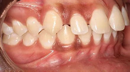 Before treatment - patient 67