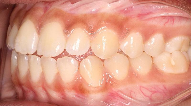 Before treatment - patient 27