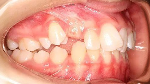 Before treatment - patient 69