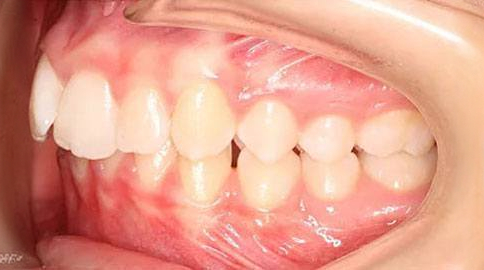 Before treatment - patient 70