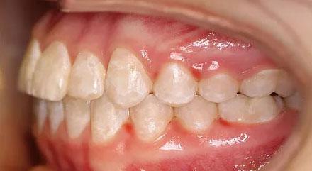 After treatment - patient 73