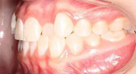 Before treatment - patient 73