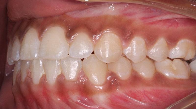 After treatment - patient 27