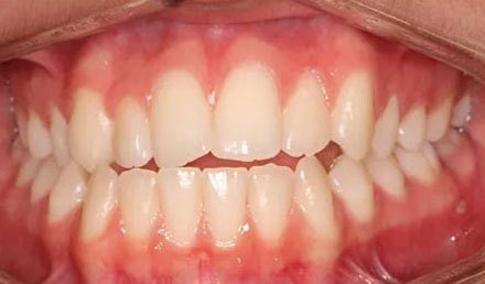 Before treatment - patient 82