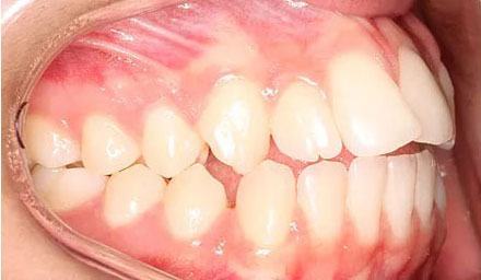 Before treatment - patient 83