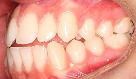 Before treatment - patient 84