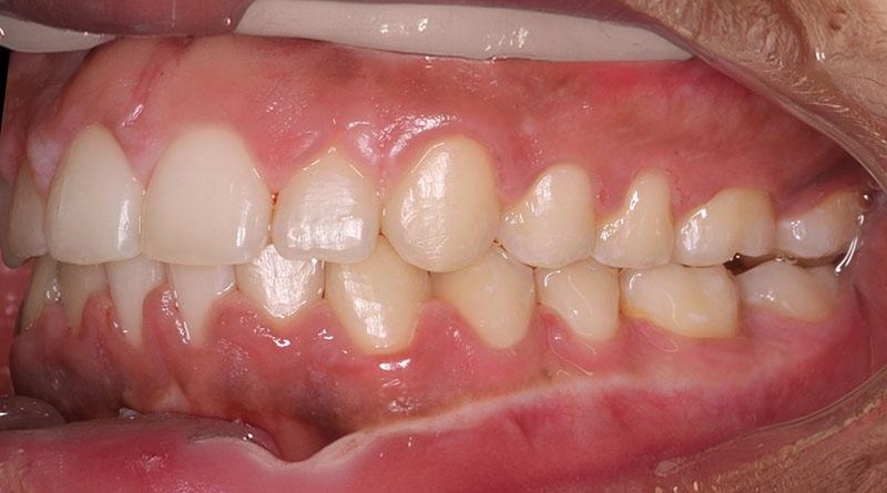 After treatment - patient 7