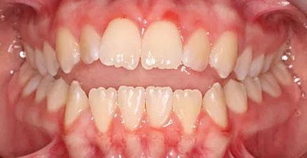 Before treatment - patient 88