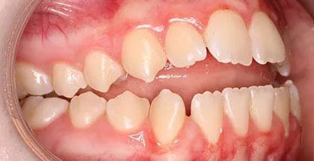 Before treatment - patient 89