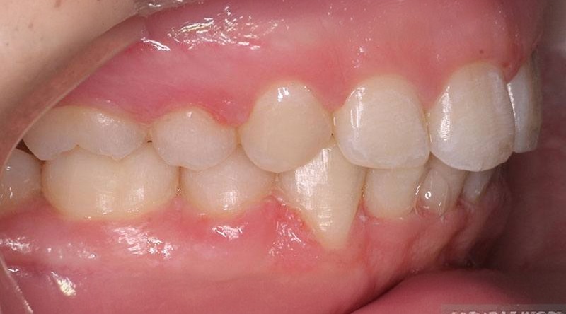 After treatment - patient 34