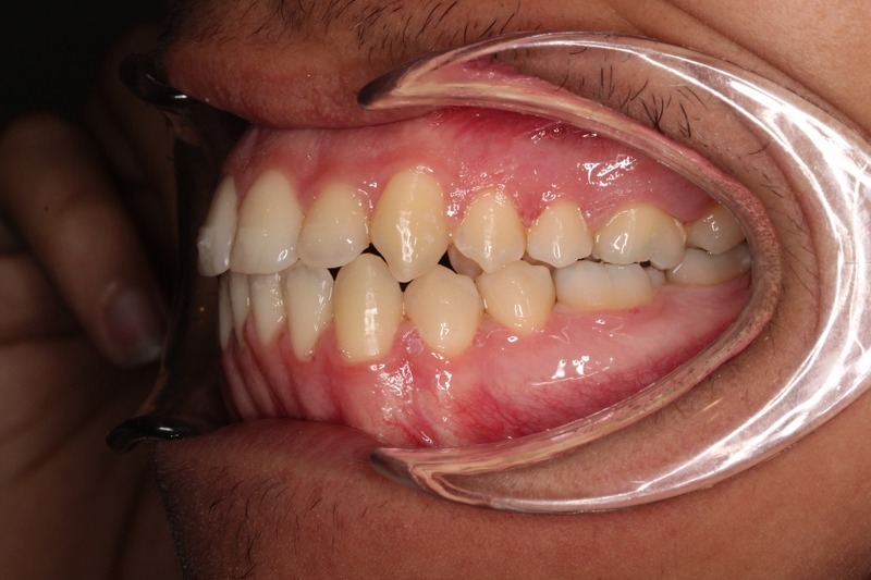 After treatment - patient 96