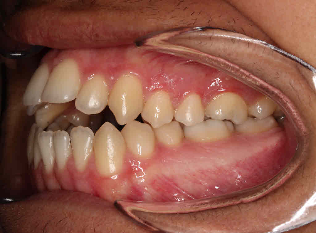 Before treatment - patient 96