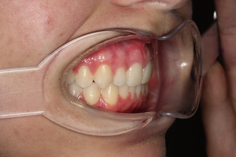 After treatment - patient 99