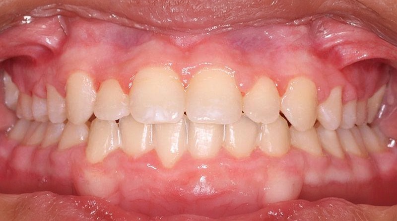 After treatment - patient 9