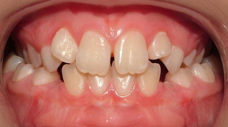 Before treatment - patient 2