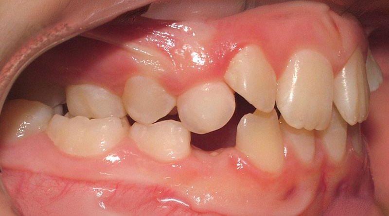Before treatment - patient 3