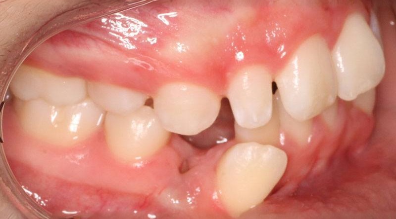 Before treatment - patient 37