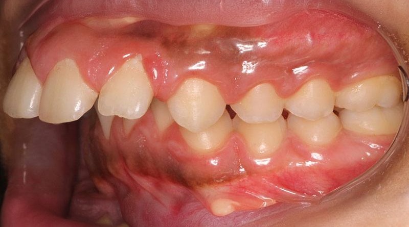 Before treatment - patient 7