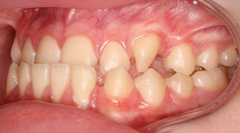 Before treatment - patient 21