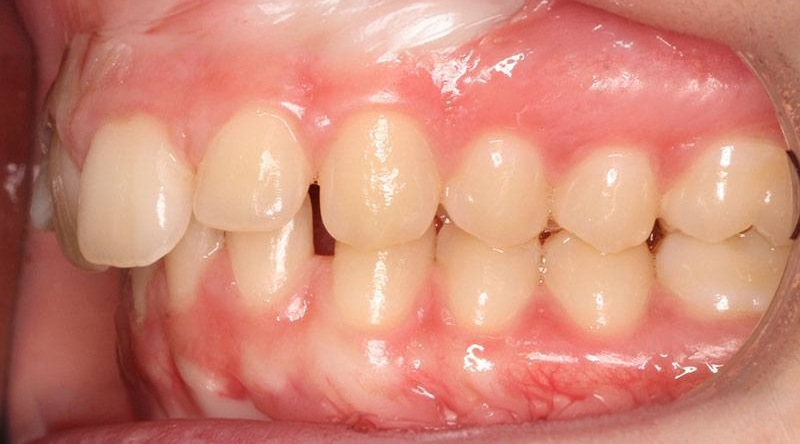 Before treatment - patient 16